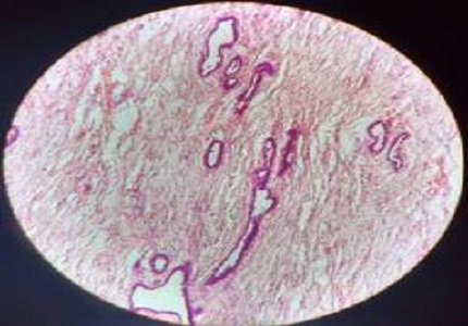 Spectrum of male breast lesions: an institutional perspective