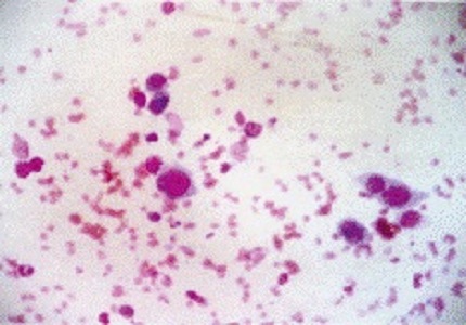 A Cross-sectional Histo-morphological Study of Vesiculobullous Lesions of Skin