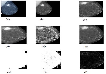 Detection of malignant tissue in mammography image using morphology based segmentation technique