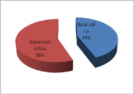 A study of role of brachytherapy IR192 in treatment of eyelid tumors