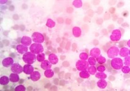 Diagnostic evaluation of pancytopenia - a prospective institutional study in North-East India