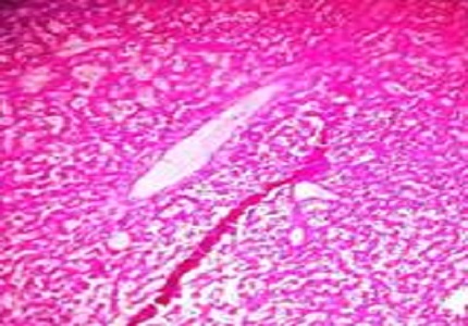 Study on various congenital anomalies in fetal autopsy
