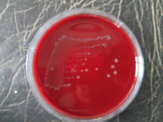 Estimation of prevalence and risk factors for clostridium difficile infection: a neglected pathogen in a tertiary care setting in India