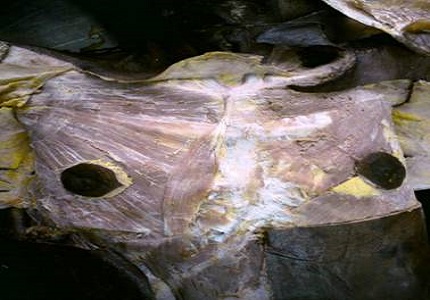 Study of sternalis muscle in north Indian population- a cadaveric study