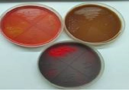 Asymptomatic urinary tract infection with multidrug resistant pathogens in retro positive patients on ART