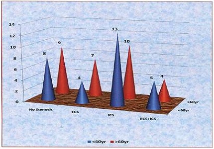 MRA evaluation of cerebrovascular stenosis and its association with acute stroke in Indian patients