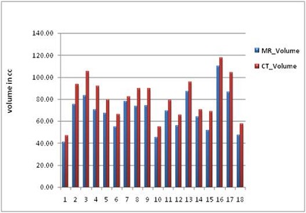 Comparison of CT only contour with MRI guided contouring in external beam radiotherapy for carcinoma rectum