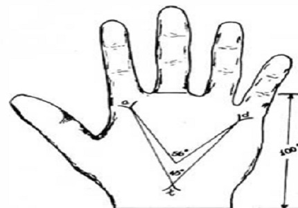 Dermatoglyphics patterns in patients suffering from primary amenorrhea and control population